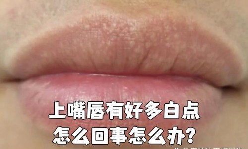 月经期间能用 硼酸溶液敷脸吗有影响吗-月经期间能用 硼酸溶液敷脸吗网 - 月经期间能用 硼酸溶液敷脸吗,月经期间能用 硼酸溶液敷脸吗女生